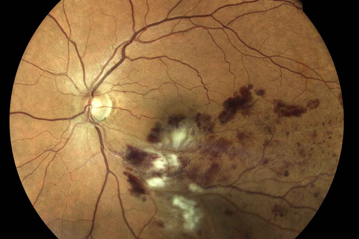 Medical-Eye-Care